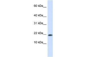 GABARAPL2 antibody used at 1 ug/ml to detect target protein. (GABARAPL2 anticorps)