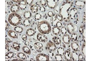 Image no. 7 for anti-Phosphoinositide-3-Kinase, Catalytic, gamma Polypeptide (PIK3CG) antibody (ABIN1500207)