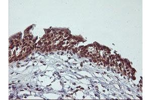 Image no. 4 for anti-Cytochrome P450, Family 2, Subfamily A, Polypeptide 6 (CYP2A6) antibody (ABIN1497724)