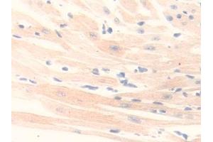 Detection of MAOB in Mouse Heart Tissue using Polyclonal Antibody to Monoamine Oxidase B (MAOB)