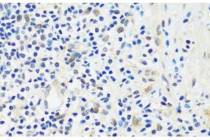 Immunohistochemistry of paraffin-embedded Human appendix using ASCL4 Polyclonal Antibody at dilution of 1:100 (40x lens). (ASCL4 anticorps)