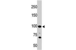 The ACE2 polyclonal antibody  is used in Western blot to detect ACE2 in 293 cell lysate. (ACE2 anticorps  (AA 773-805))