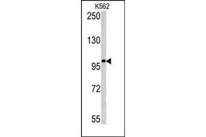 Image no. 1 for anti-Melanoma Antigen Family C, 1 (MAGEC1) (C-Term) antibody (ABIN358656) (MAGEC1 anticorps  (C-Term))