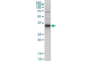 ZIC4 monoclonal antibody (M05), clone 1A9 Western Blot analysis of ZIC4 expression in Hela S3 NE .