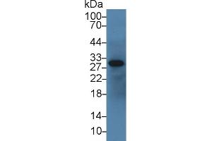 Detection of IGFBP1 in Bovine Serum using Polyclonal Antibody to Insulin Like Growth Factor Binding Protein 1 (IGFBP1)