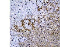IHC analysis of Synaptotagmin 1 using anti-Synaptotagmin 1 antibody .
