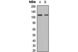 Western blot analysis of TSHZ1 expression in HEK293T (A), Raw264. (TSHZ1 anticorps  (C-Term))
