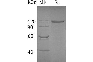 Western Blotting (WB) image for Galactosidase, beta 1 (GLB1) protein (Fc Tag) (ABIN7320988)