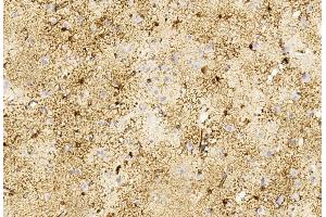 Immunohistochemical analysis of paraffin-embedded Human brain section using Pink1 B. (GFAP anticorps)