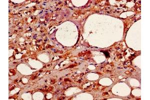 Immunohistochemistry of paraffin-embedded human adrenal gland tissue using ABIN7146893 at dilution of 1:100