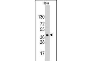 Western blot analysis of anti-HDGF Pab (ABIN390356 and ABIN2840767) in Hela cell line lysates (35 μg/lane). (HDGF anticorps  (C-Term))