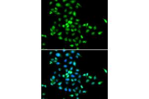 Immunofluorescence (IF) image for anti-Shwachman-Bodian-Diamond Syndrome (SBDS) antibody (ABIN1980243)