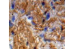 Used in DAB staining on fromalin fixed paraffin-embedded Brain tissue