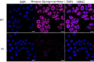 Immunocytochemical staining of HeLa cells using Phospho-Glycogen synthase 1 (S641) antibody (ABIN7798774), 1:1,000), Top panel: wild-type (WT), Bottom panal: Phospho-Glycogen synthase 1 (S641) shRNA knockdown (KD). (Recombinant Glycogen Synthase 1 anticorps  (pSer641))