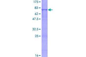 Image no. 1 for Bardet-Biedl Syndrome 1 (BBS1) (AA 1-463) protein (GST tag) (ABIN7565553)