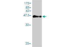 Western Blot detection against Immunogen (46. (DNAH14 anticorps  (AA 1-189))