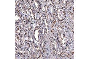 IHC analysis of TRMT2B using anti-TRMT2B antibody (ABIN7599456). (TRMT2B anticorps  (AA 1-504))