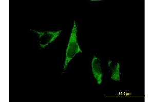 Immunofluorescence of purified MaxPab antibody to MGC48915 on HeLa cell. (C1QTNF9 anticorps  (AA 1-333))