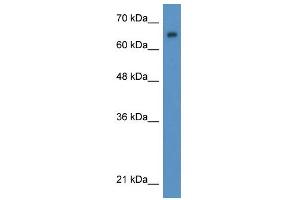 WB Suggested Anti-WT1 Antibody Titration:  0. (WT1 anticorps  (N-Term))