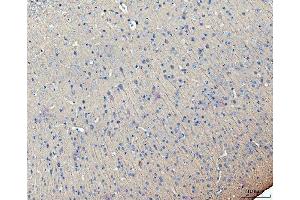 IHC analysis of MAP2 using anti-MAP2 antibody (ABIN7601483).