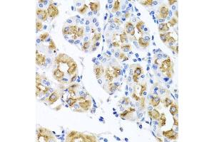 Immunohistochemistry of paraffin-embedded human stomach using FECH antibody (ABIN6130423, ABIN6140573, ABIN6140574 and ABIN6224474) at dilution of 1:100 (40x lens).
