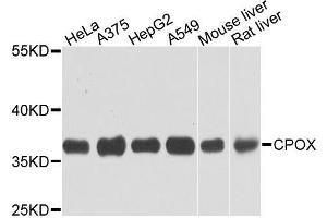 Western blot analysis of extracts of various cells, using CPOX antibody. (CPOX anticorps)