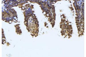 ABIN6273994 at 1/100 staining Mouse colon tissue by IHC-P. (TUBB1 anticorps)