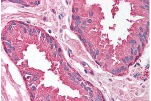 Human Prostate (formalin-fixed, paraffin-embedded) stained with PSMA1 antibody ABIN214137 at 5 ug/ml followed by biotinylated goat anti-rabbit IgG secondary antibody ABIN481713, alkaline phosphatase-streptavidin and chromogen.