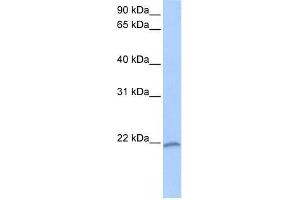 Western Blot showing C8orf77 antibody used at a concentration of 1-2 ug/ml to detect its target protein. (C8orf77 anticorps  (C-Term))