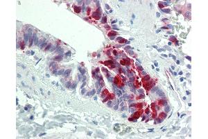 Anti-ALK1 / SLPI antibody IHC staining of human lung, respiratory epithelium. (SLPI anticorps  (AA 11-60))