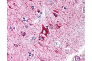Anti-GABRA1 antibody IHC of human brain, cortex.