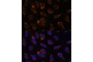 Immunofluorescence analysis of U-2 OS cells using TSFM Polyclonal Antibody (ABIN7271022) at dilution of 1:100 (40x lens).