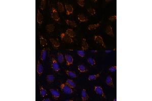 Immunofluorescence analysis of U-2 OS cells using TSFM Polyclonal Antibody (ABIN7271022) at dilution of 1:100 (40x lens). (TSFM anticorps  (AA 245-346))