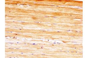 IHC image of ABIN7142091 diluted at 1:400 and staining in paraffin-embedded human skeletal muscle tissue performed on a Leica BondTM system.