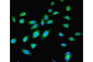 Immunofluorescent analysis of Hela cells using ABIN7174654 at dilution of 1:100 and Alexa Fluor 488-congugated AffiniPure Goat Anti-Rabbit IgG(H+L)