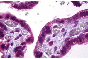 Anti-SKI antibody IHC staining of human placenta.