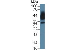 Detection of KLK13 in Human Saliva using Polyclonal Antibody to Kallikrein 13 (KLK13)