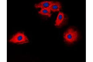 Immunofluorescent analysis of Claudin 6 staining in HuvEc cells. (Claudin 6 anticorps  (Center))