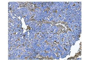 IHC analysis of CD13/ANPEP using anti-CD13/ANPEP antibody (ABIN7600088). (CD13 anticorps  (AA 148-966))