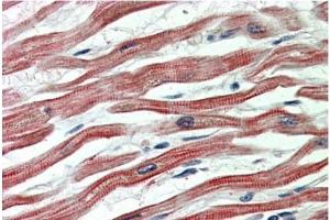 Staining of paraffin embedded Human Heart using EPM2AIP1 antibody at 5 µg/ml. (EPM2AIP1 anticorps  (Internal Region))