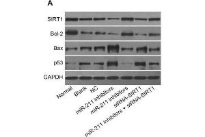 The protein expressions of SIRT1, Bcl-2, Bax, and p53 in each group(A) The protein strip chart, (B) the relative protein expression in seven groups, *, P<0. (Bcl-2 anticorps  (AA 151-239))