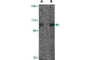 Western blot analysis of VPS53 in 293 cell lysate with VPS53 polyclonal antibody  at (A) 0.