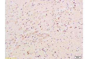 Formalin-fixed and paraffin embedded mouse brain tissue labeled with Anti-CHRNA7 Polyclonal Antibody, Unconjugated  at 1:200, followed by conjugation to the secondary antibody and DAB staining