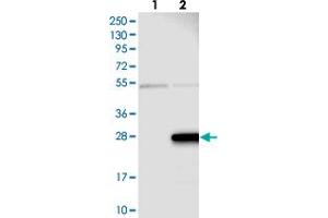 Western blot analysis of Lane 1: Negative control (vector only transfected HEK293T lysate), Lane 2: Over-expression Lysate (Co-expressed with a C-terminal myc-DDK tag (~3. (ZMAT5 anticorps)