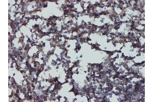 Immunoperoxidase of monoclonal antibody to CD48 on formalin-fixed paraffin-embedded human tonsil tissue.