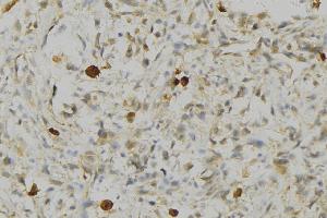 ABIN6276738 at 1/100 staining Human gastric tissue by IHC-P. (HLA-DRA anticorps)