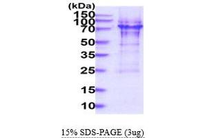 SDS-PAGE (SDS) image for Ribosomal Protein S6 Kinase, 70kDa, Polypeptide 1 (RPS6KB1) (AA 1-525) protein (His tag) (ABIN6388171)