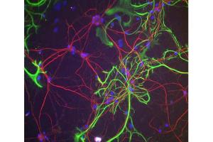 Neurofilament H Antibody - Immunofluorescence.