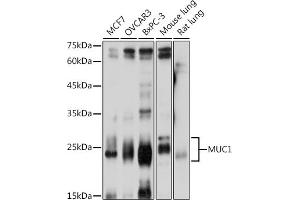 Western blot analysis of extracts of various cell lines, using MUC1 antibody (ABIN6131522, ABIN6144194, ABIN6144195 and ABIN6213810) at 1:1000 dilution. (MUC1 anticorps  (AA 1182-1255))