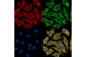 c-Kit Mouse Monoclonal Antibody staining HepG2 cells by IF/ICC. (KIT anticorps  (Internal Region))